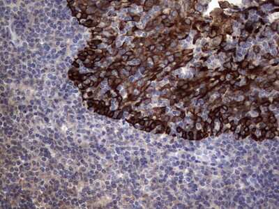 Immunohistochemistry: CCL19/MIP-3 beta Antibody (OTI2A12) [NBP2-46082]