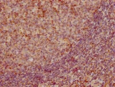 Immunohistochemistry: CCL19/MIP-3 beta Antibody (3A12) [NBP3-15143]