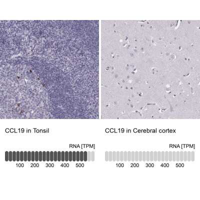 Immunohistochemistry-Paraffin: CCL19/MIP-3 beta Antibody [NBP2-56275]