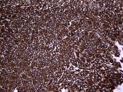 Immunohistochemistry: CCL19/MIP-3 beta Antibody (OTI2A12) - Azide and BSA Free [NBP2-71278]