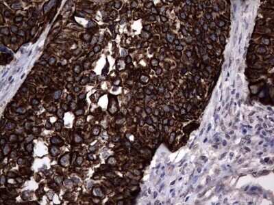 Immunohistochemistry: CCL19/MIP-3 beta Antibody (OTI2A12) - Azide and BSA Free [NBP2-71278]