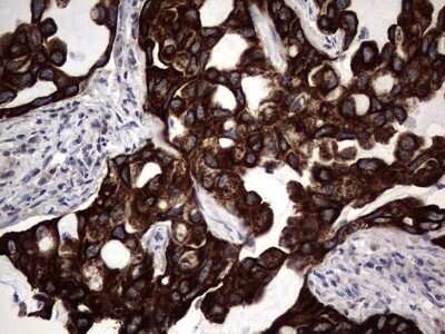 Immunohistochemistry: CCL19/MIP-3 beta Antibody (OTI2A12) - Azide and BSA Free [NBP2-71278]