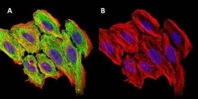Immunocytochemistry/ Immunofluorescence: CCL2/MCP1 Antibody (2D8) - Azide and BSA Free [NBP2-80618]