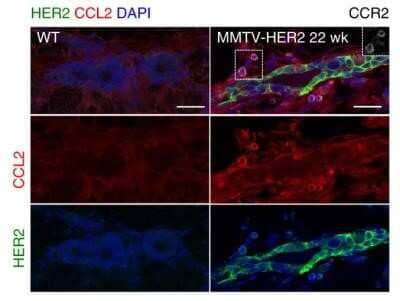 Immunohistochemistry: CCL2/MCP1 Antibody (2D8) - Azide and BSA Free [NBP2-80618]