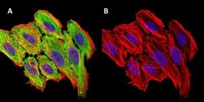 Immunocytochemistry/ Immunofluorescence: CCL2/MCP1 Antibody (2D8) - BSA Free [NBP2-22115]