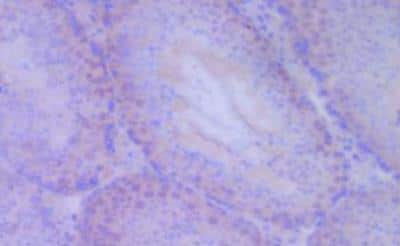 Immunohistochemistry-Frozen: CCL2/MCP1 Antibody (ECE.2) [NBP1-42312]