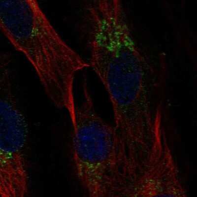 Immunocytochemistry/ Immunofluorescence: CCL2/MCP1 Antibody [NBP1-81837]