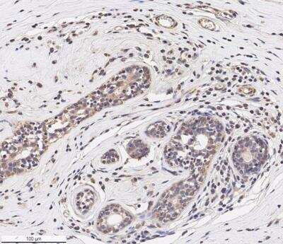 Immunohistochemistry-Paraffin: CCL2/MCP1 Antibody - BSA Free [NBP1-07035]