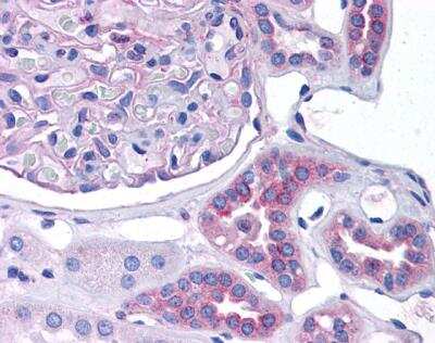 Immunohistochemistry-Paraffin: CCL2/MCP1 Antibody [NBP1-79938]