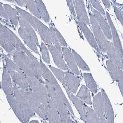 Immunohistochemistry-Paraffin: CCL2/MCP1 Antibody [NBP1-81837]