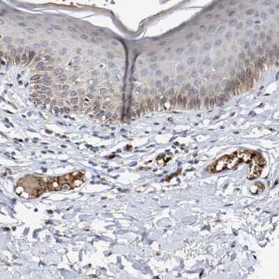 Immunohistochemistry-Paraffin: CCL2/MCP1 Antibody [NBP1-81837]