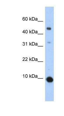 Western Blot: CCL2/MCP1 Antibody [NBP1-79938]