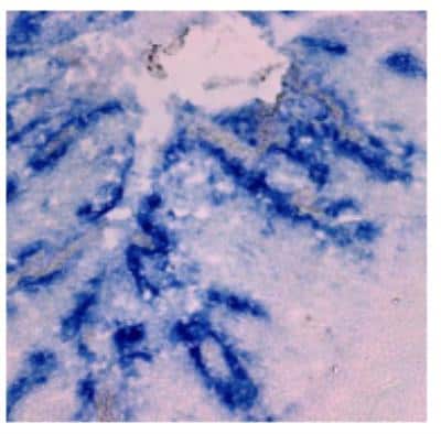 Immunohistochemistry: CCL20/MIP-3 alpha Antibody (308B7.06) [DDX0431P-100]