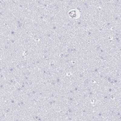 Immunohistochemistry-Paraffin: CCL21/6Ckine Antibody [NBP2-37928]