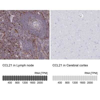 Immunohistochemistry-Paraffin: CCL21/6Ckine Antibody [NBP2-37928]