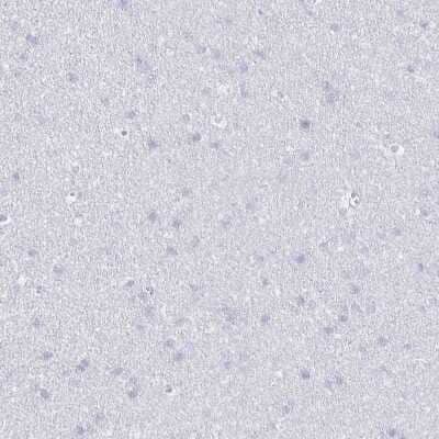 Immunohistochemistry-Paraffin: CCL21/6Ckine Antibody [NBP2-37928]