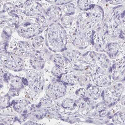 Immunohistochemistry-Paraffin: CCL21/6Ckine Antibody [NBP2-37928]