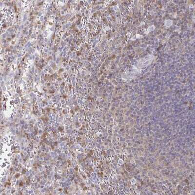 Immunohistochemistry-Paraffin: CCL21/6Ckine Antibody [NBP2-37928]
