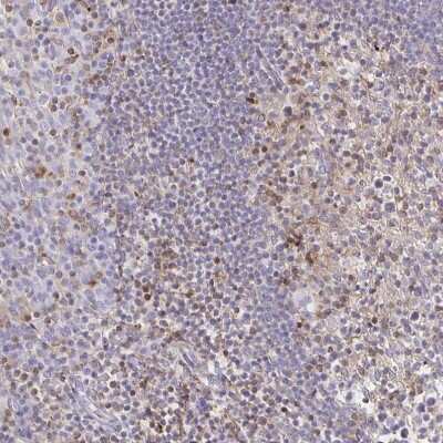 Immunohistochemistry-Paraffin: CCL21/6Ckine Antibody [NBP2-37928]