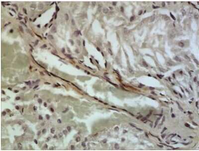 Immunohistochemistry-Paraffin: CCL21/6Ckine Antibody (RM0174-10K10) - Azide and BSA Free [NBP2-12104]