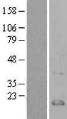 Western Blot: CCL21/6Ckine Overexpression Lysate [NBL1-08851]