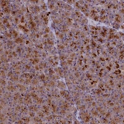 Immunohistochemistry: CCL23/Ck beta 8-1/MIP3 Antibody [NBP1-88079]