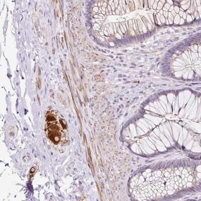 Immunohistochemistry: CCL25/TECK Antibody [NBP2-49199]