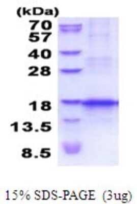 SDS-PAGE: Recombinant Human CCL25/TECK His Protein [NBP2-52003]