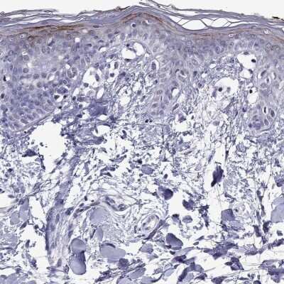 Immunohistochemistry-Paraffin: CCL27/CTACK Antibody [NBP2-62684]