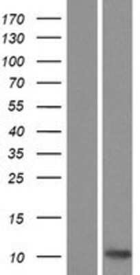 Western Blot: CCL27/CTACK Overexpression Lysate [NBP2-07595]