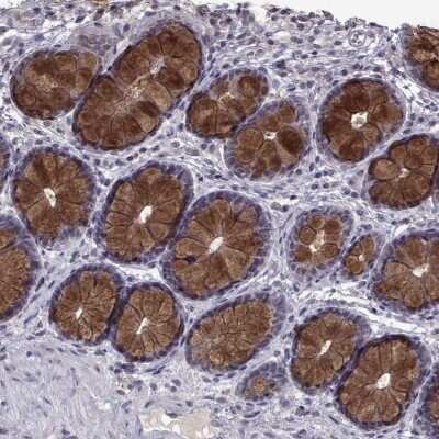 Immunohistochemistry-Paraffin: CCL28 Antibody [NBP2-69040]