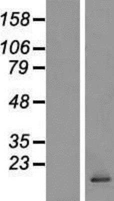 Western Blot: CCL28 Overexpression Lysate [NBL1-08855]