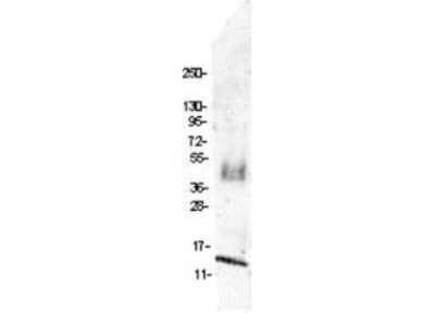 Western Blot: CCL4/MIP-1 beta Antibody [NBP1-77897]