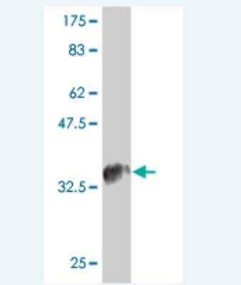 Western Blot: CCL4L2 Antibody (4G8) [H00388372-M01]