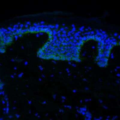 Immunohistochemistry-Frozen: CCL7/MCP-3/MARC Antibody [NBP1-82367]