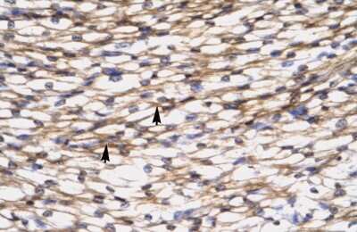 Immunohistochemistry: CCL7/MCP-3/MARC Antibody [NBP1-82367]