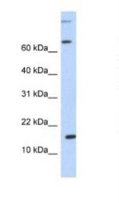 Western Blot: CCL7/MCP-3/MARC Antibody [NBP1-82367]
