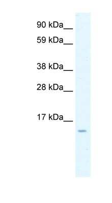 Western Blot: CCL7/MCP-3/MARC Antibody [NBP1-82367]