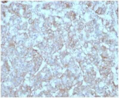 Immunohistochemistry-Paraffin: CCL8/MCP-2 Antibody (CCL8/3312) [NBP3-13769]