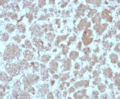 Immunohistochemistry-Paraffin: CCL8/MCP-2 Antibody (CCL8/3683) [NBP3-13770]