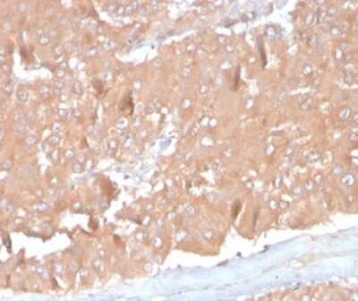 Immunohistochemistry-Paraffin: CCL8/MCP-2 Antibody (CCL8/3686) [NBP3-13771]