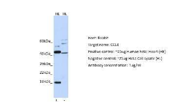 Western Blot: CCL8/MCP-2 Antibody [NBP1-79937]