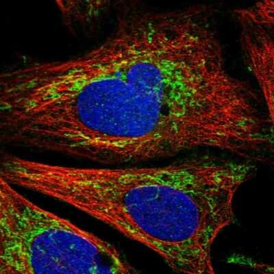 Immunocytochemistry/ Immunofluorescence: CCM2 Antibody [NBP1-86730]