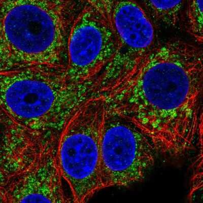 Immunocytochemistry/ Immunofluorescence: CCM2 Antibody [NBP2-56439]