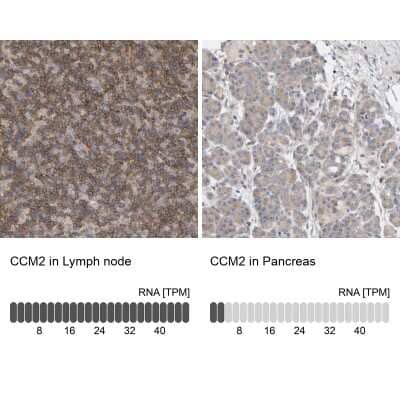 Immunohistochemistry-Paraffin: CCM2 Antibody [NBP1-86729]