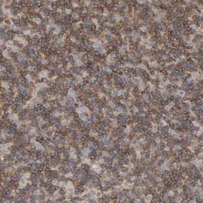 Immunohistochemistry-Paraffin: CCM2 Antibody [NBP1-86729]
