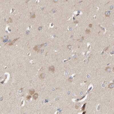 Immunohistochemistry-Paraffin: CCM2 Antibody [NBP1-86729]