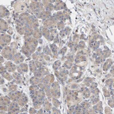 Immunohistochemistry-Paraffin: CCM2 Antibody [NBP1-86729]