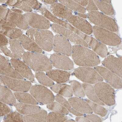 Immunohistochemistry-Paraffin: CCM2 Antibody [NBP1-86729]