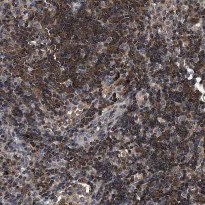 Immunohistochemistry-Paraffin: CCM2 Antibody [NBP1-86730]